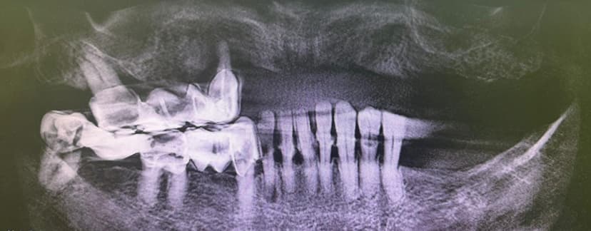 Radiografie inițială